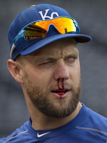 打撃練習中にボールが直撃して鼻血を出すロイヤルズのアレックス・ゴードン外野手　（ＡＰ）