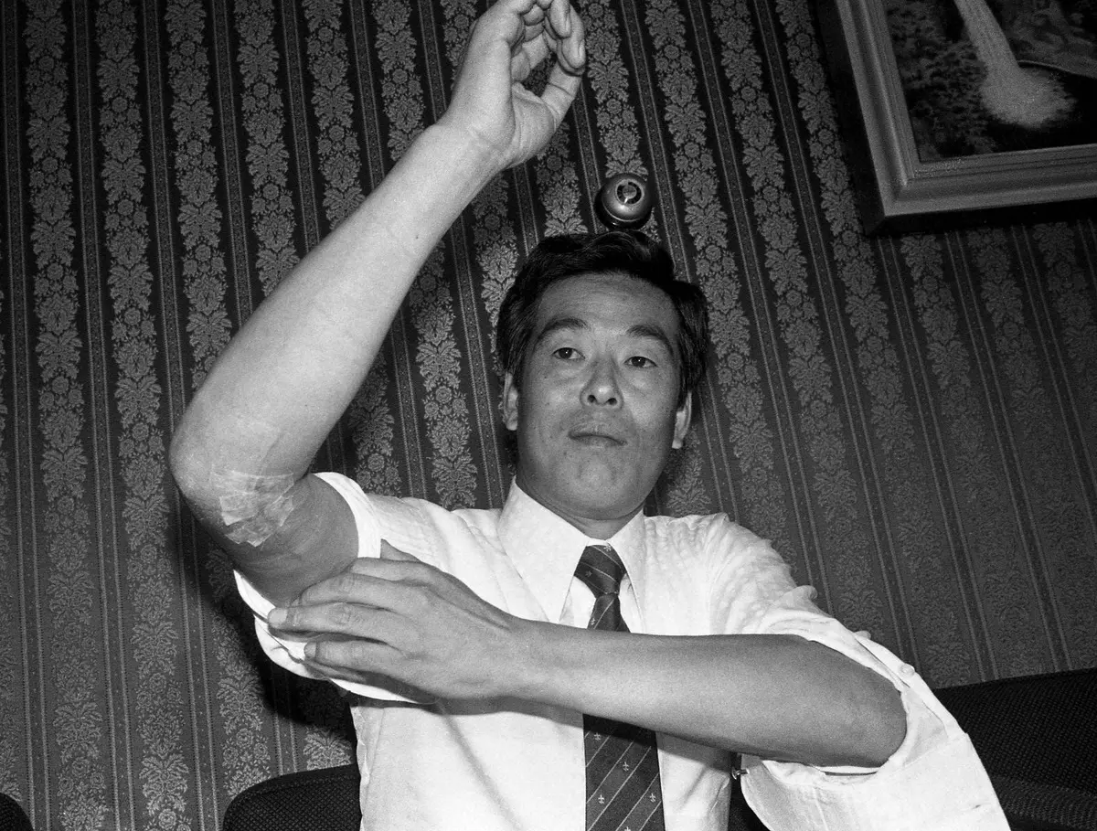 右ひじの手術を受けた村田兆冶さんは手術跡を公開。83年撮影