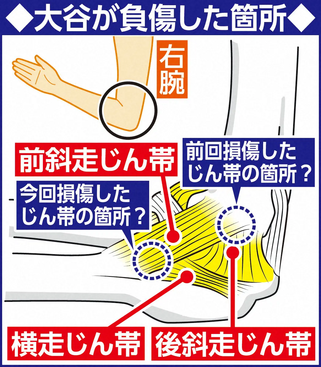 【画像・写真】どうなる大谷、TJ手術執刀経験者・馬見塚氏が考える治療法　手術か保存療法か　未来を見据えた挑戦に