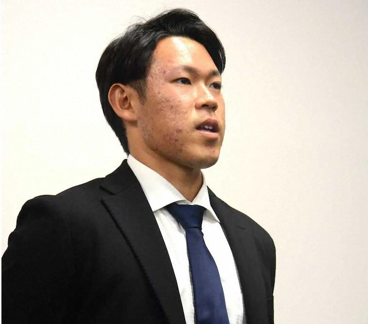 【画像・写真】日本ハム根本が更改　ダウン提示にサイン　来季の巻き返しへ「一日一日を全力で」