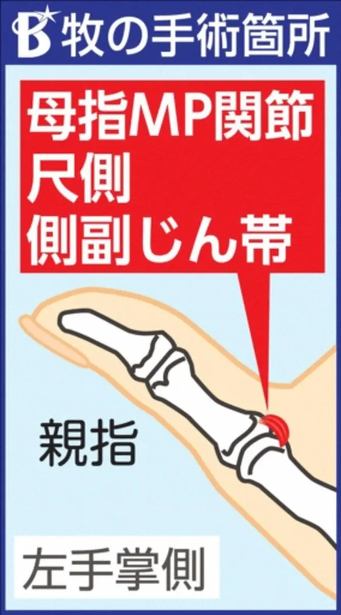 【画像・写真】DeNA・牧の手術箇所