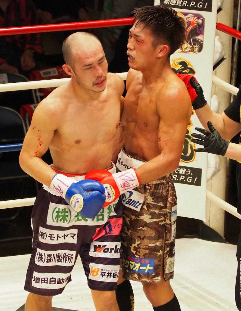 【画像・写真】永田大士、負傷判定引き分けでベルト死守「初防衛できたので反省を次につなげたい」