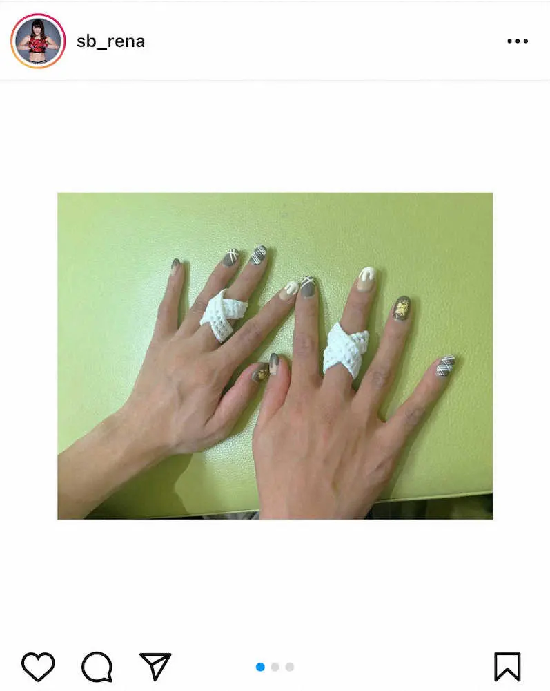 【画像・写真】RENA「#なんで中指だけなん」と負傷を明かす　でも前向きにつづる「フィジカル重視で頑張りたい」