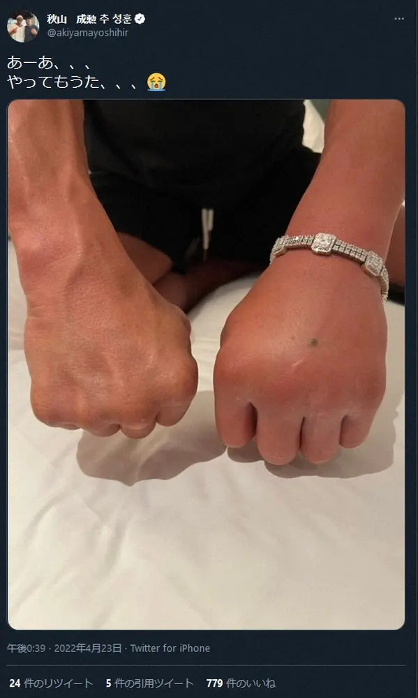 【画像・写真】秋山成勲「あーあ、、やってもうた」もレントゲンで拳は折れておらず「ドラえもんみたい」などと心配する声