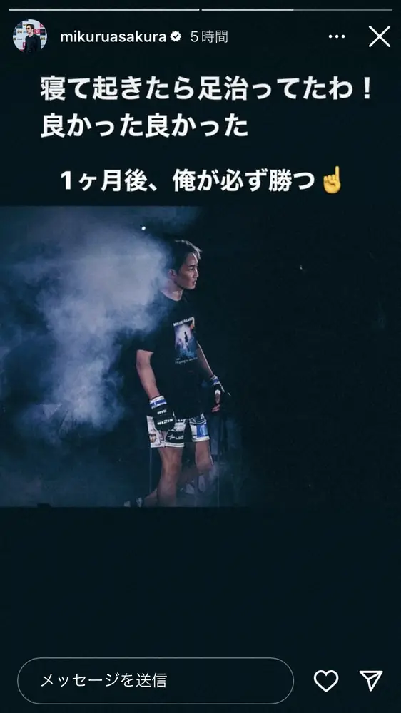 【画像・写真】朝倉未来、驚くほど腫れあがった足をアップも…「寝て起きたら治ってたわ!良かった良かった」