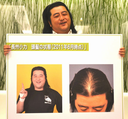 【画像・写真】長州小力　薄毛を告白「このままでは武藤さんに…」
