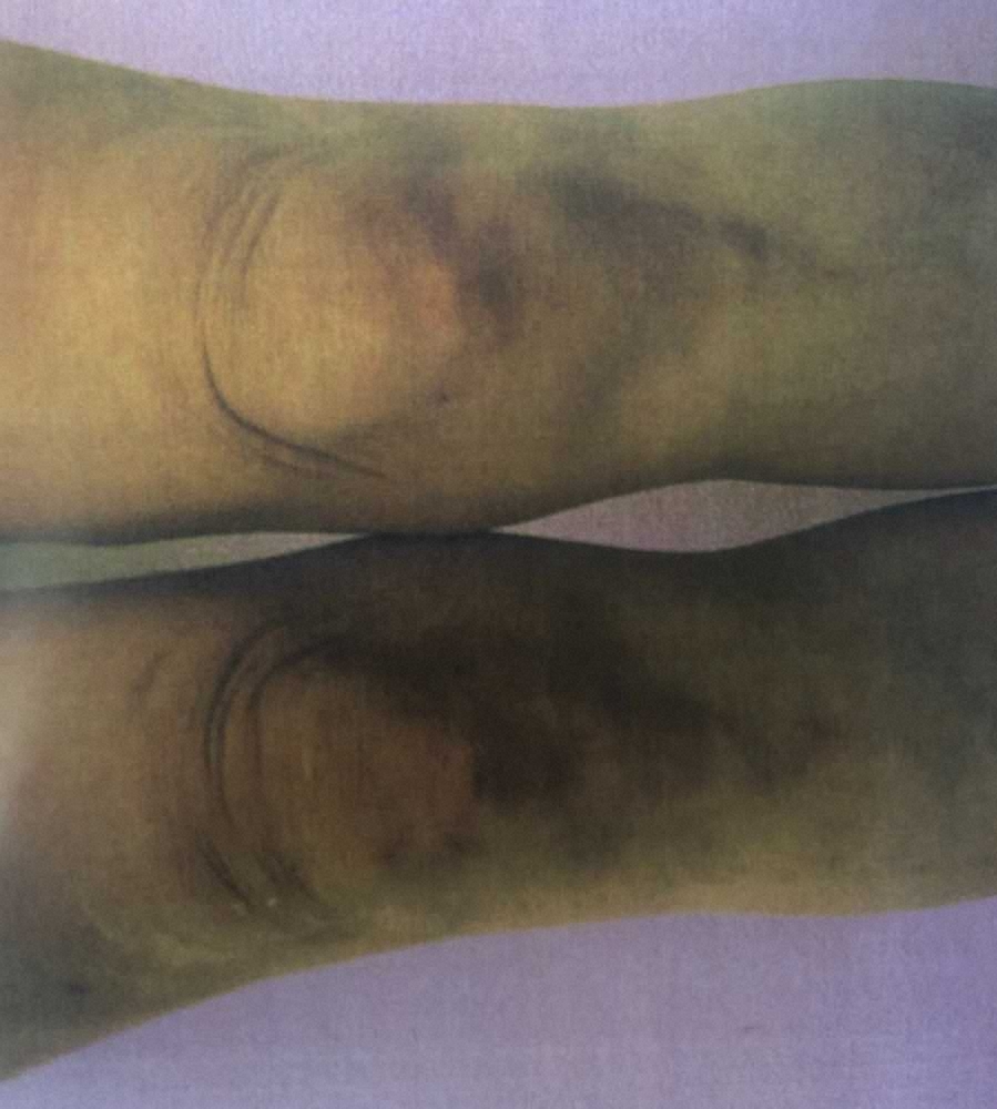 カイヤの膝周辺のあざ スポニチ Sponichi Annex 芸能