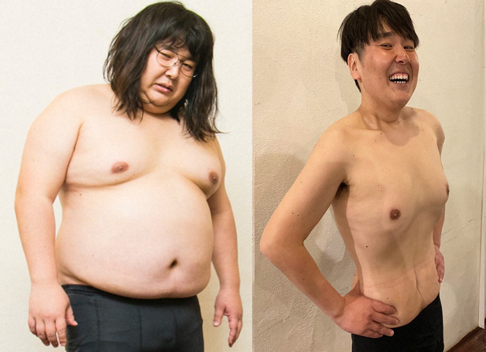 50キロのダイエットに成功したピン芸人のガリガリガリクソン。同一人物とは思えぬ姿を披露した