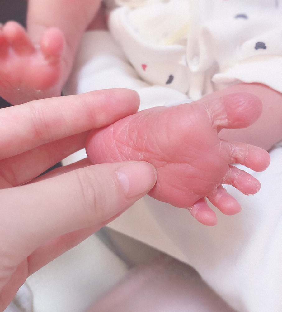 【画像・写真】女性メタルバンド「Aldious」トキ　第1子出産を報告「壮絶なお産でしたが」