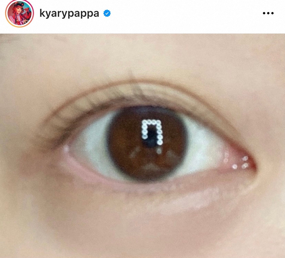 【画像・写真】きゃりー　ICLで視力アップし感動　目元写真添え「両目が2.0に…！」
