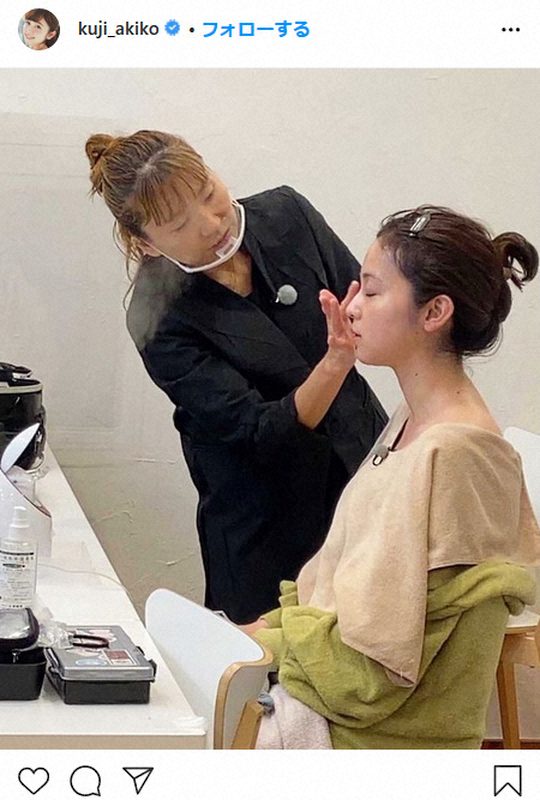 【画像・写真】フジ久慈暁子アナ“すっぴん”横顔公開にフォロワー称賛「透き通る美肌」「正面から見たい」