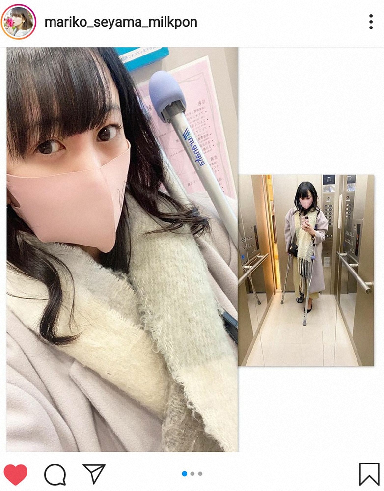 【画像・写真】脊山麻理子が人生初の骨折　左足小指の骨にはくっきりと亀裂が