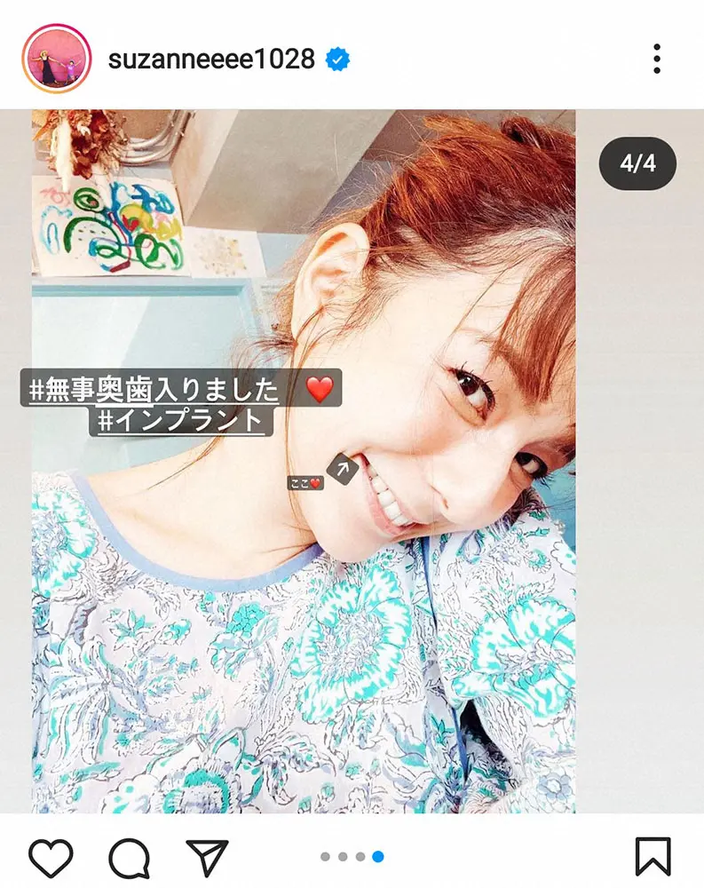 【画像・写真】スザンヌ　インプラントで新しい歯入り歓喜！なぜかシースルー服で“比較”も