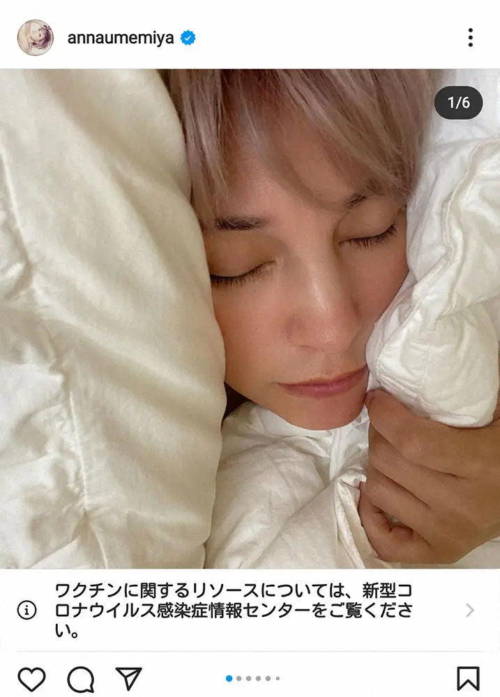 【画像・写真】梅宮アンナ　2回目新型コロナのワクチン副反応に苦しむ「何年ぶりだろう　熱が出て動けなくなったの」