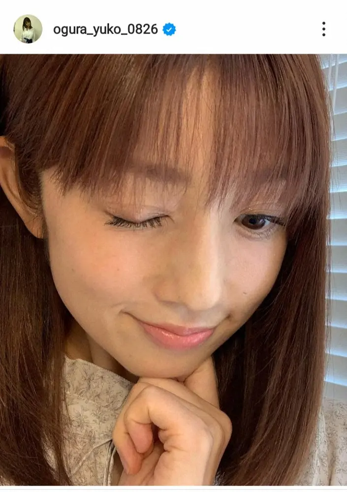 【画像・写真】小倉優子　右目にできた「ものもらい」を切除することをアップ写真とともに報告　「このようになるなんて」