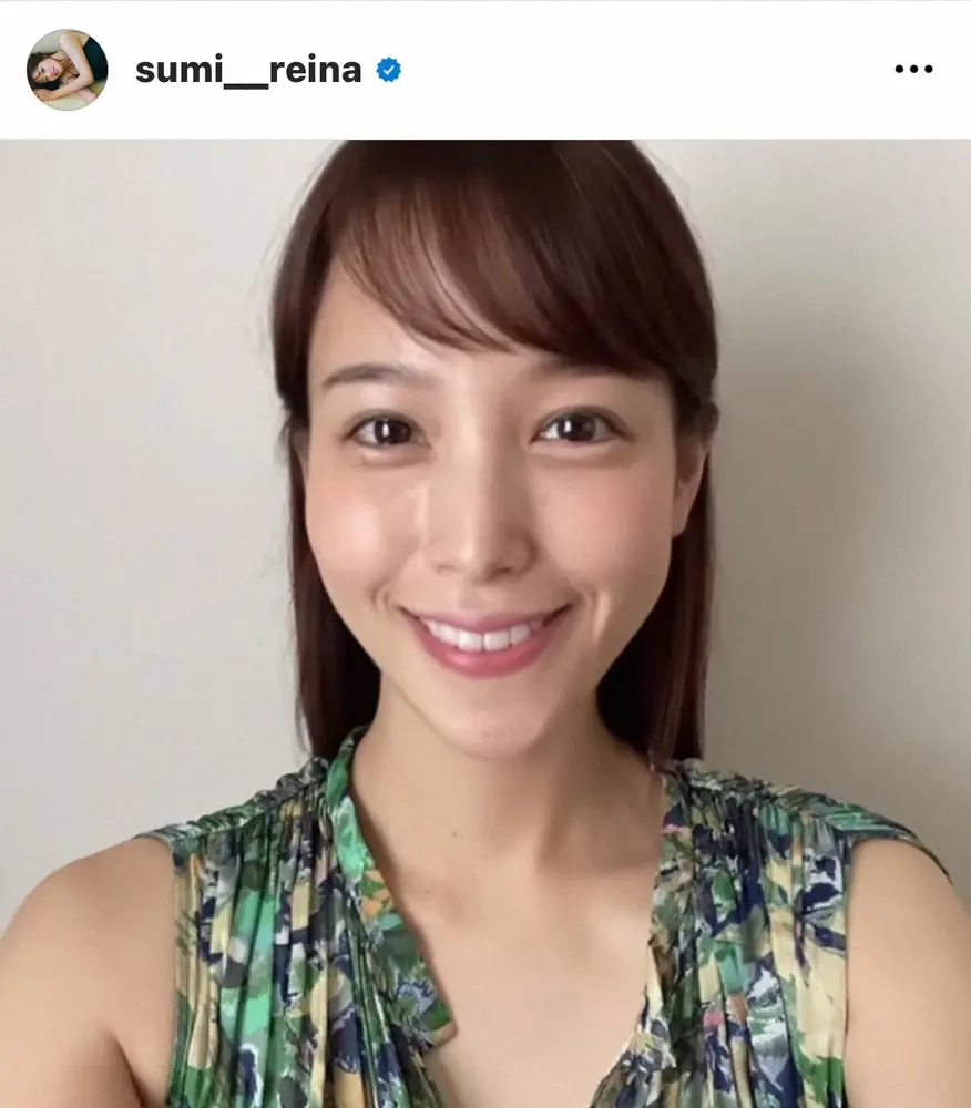 【画像・写真】鷲見玲奈アナ　顔のホクロ「取ろうかな」　ファン賛否「幸運のホクロかも」「気になるなら…」