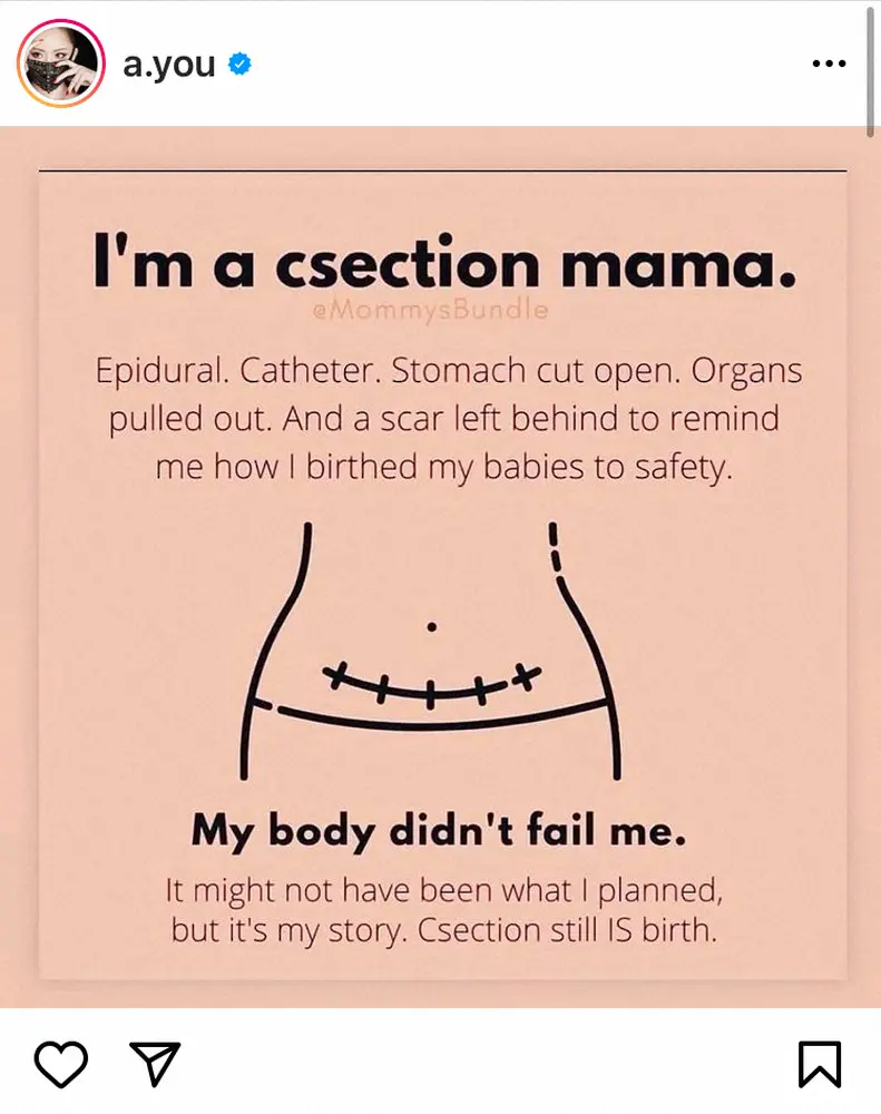 【画像・写真】浜崎あゆみ　帝王切開への偏見に「私は自分のお腹の傷を愛おしく誇りに思う」