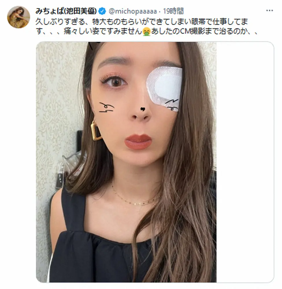 【画像・写真】みちょぱ　「特大ものもらいができてしまい」痛々しい眼帯姿に「はやくなおしてね」「お大事に」の声