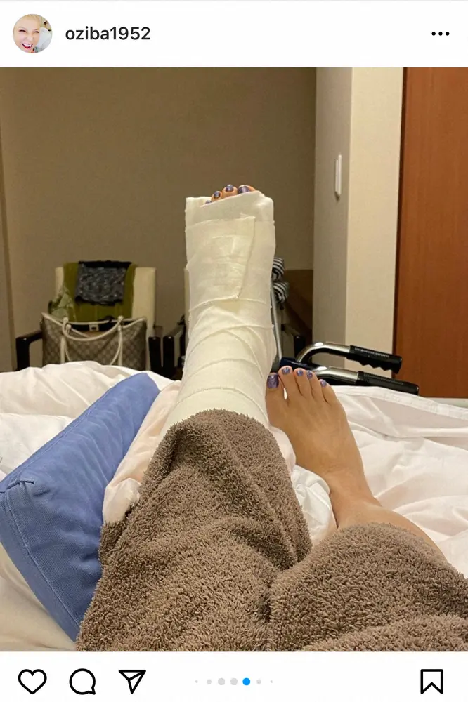 【画像・写真】池畑慎之介　手術成功を報告「麻酔切れてからの痛みに怯えてます」　ゴルフで転倒し左足首骨折