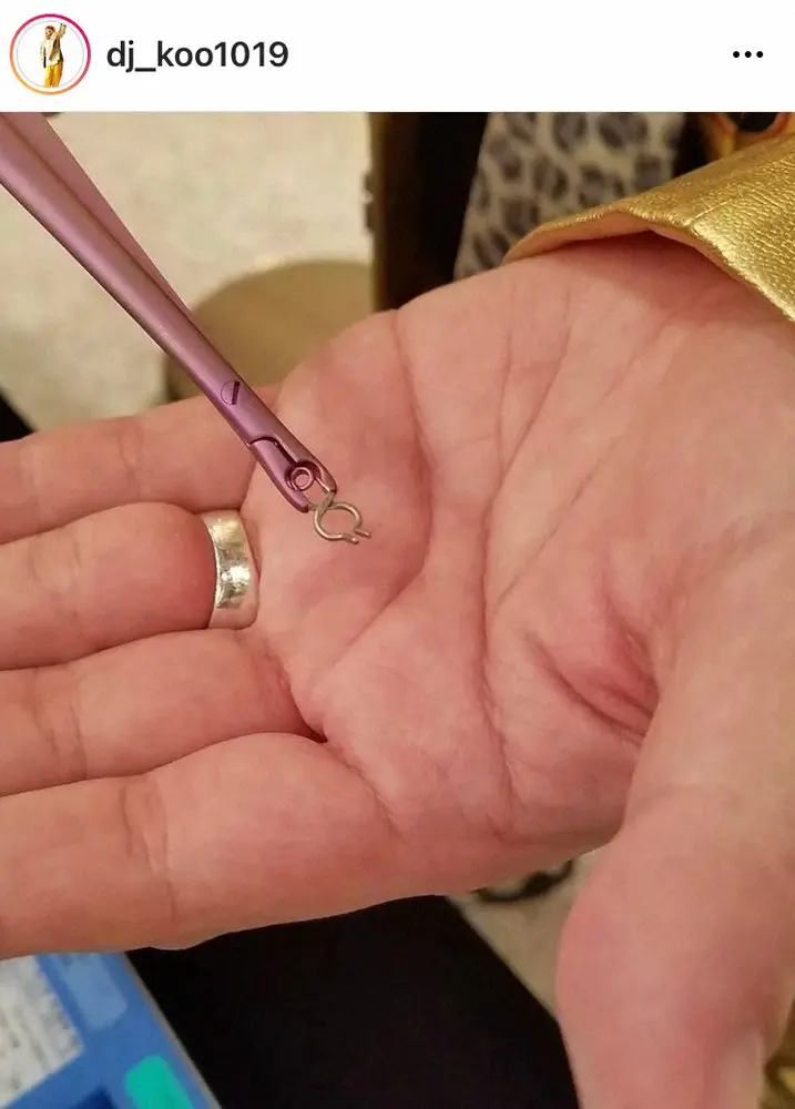 【画像・写真】DJ　KOO　脳動脈瘤手術から5年　頭の中にクリップ3つ「奇跡のアクセサリーが一生付いてる気分」