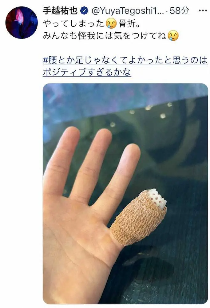 【画像・写真】手越祐也　左手小指の骨折をツイッターで報告「やってしまった」