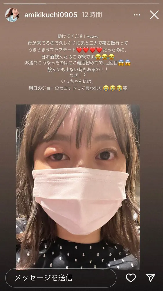 【画像・写真】菊地亜美　「久しぶりに夜に夫と二人でデート」のはずが…「助けてください」瞼腫れ上がった姿に心配の声