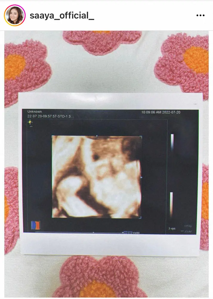 【画像・写真】紗綾　妊娠8カ月のエコー写真公開「妊婦らしい身体になるのがスゴく不思議」「現在1359gの赤ちゃん」