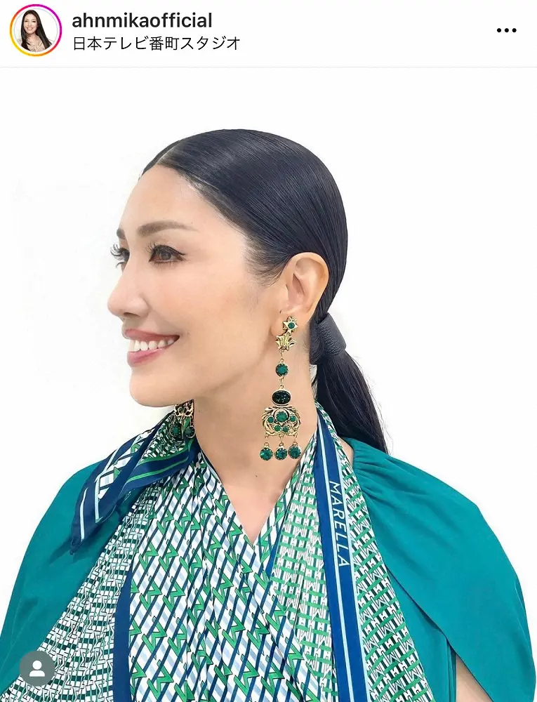 【画像・写真】アンミカ、オシャレすぎるギプスコーデ公開　ブランドスカーフで手術後の手を固定「さすがプラス思考」