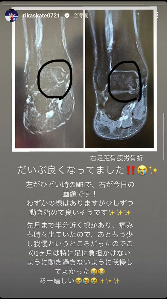 【画像・写真】紀平梨花公式インスタグラム（＠rikaskate0721）から