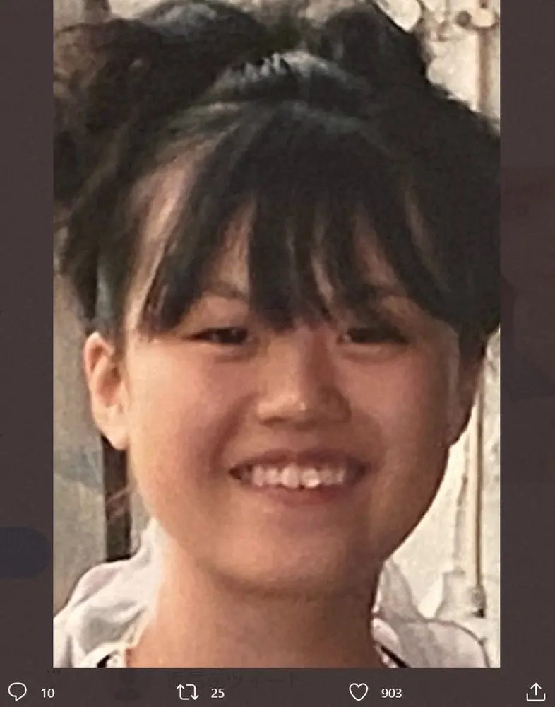 【画像・写真】総額1350万円の整形ユーチューバー・轟ちゃん　整形前の顔を公開し反響「キレイになってる！！」