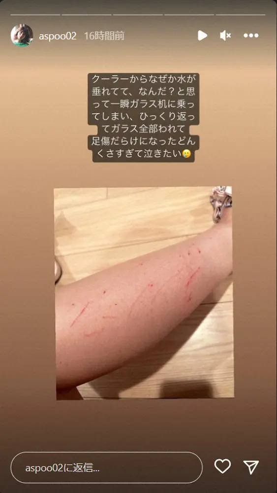 【画像・写真】岸明日香　血だらけの脚を投稿　自宅で「ひっくり返って」ガラス粉砕しけが　「泣きたい」