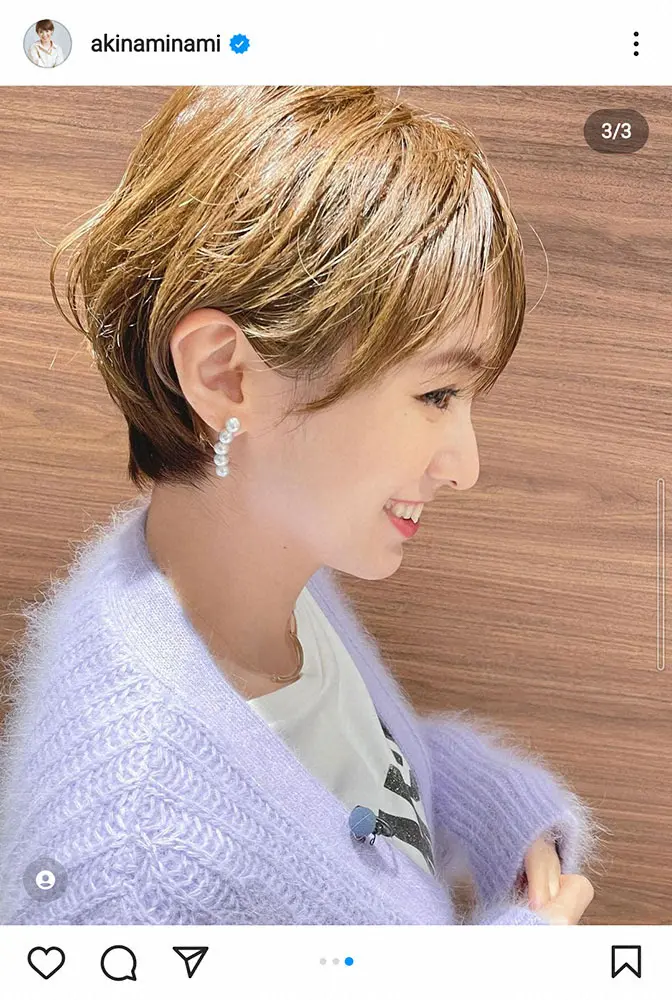 【画像・写真】南明奈　出産から3カ月産後抜け毛が始まったと報告「思っていた以上に抜けるからビックリ」