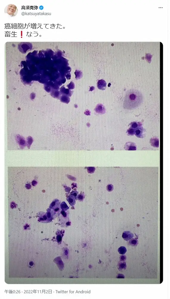 【画像・写真】高須克弥院長　がん細胞増殖を報告「まだまだ手はある。死んでたまるか」