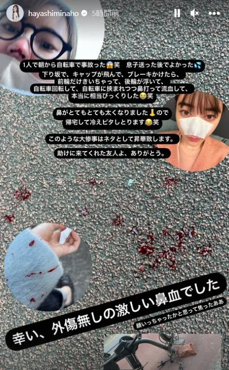 【画像・写真】シングルマザーの元TBS・林みなほアナ、長男送迎後の自転車で事故に遭ったと報告