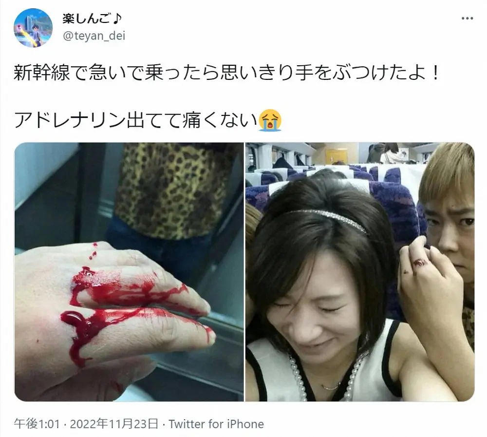 【画像・写真】楽しんご　人生初の骨折で今月30日に手術へ「辛い時は本当に辛いんです…涙が溢れてくる」