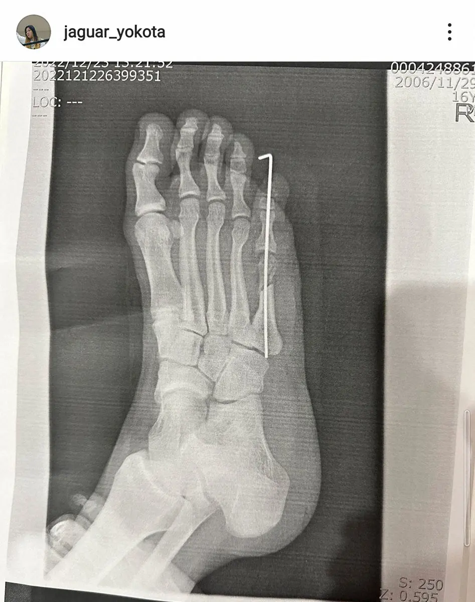 【画像・写真】ジャガー横田　長男・大維志くんが公表の入院理由「肝硬変」を否定　足の小指の手術と明かし謝罪