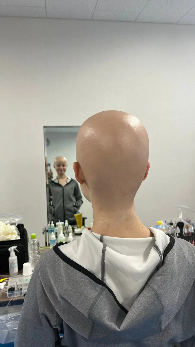 【画像・写真】橋本環奈　“エイリアン橋本”の苦労を明かす「だいぶ頭出てます」