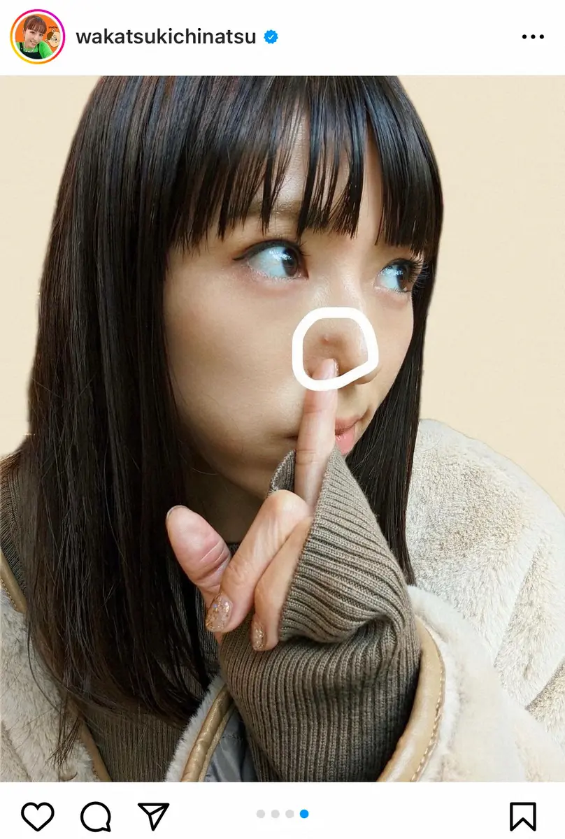 【画像・写真】若槻千夏　新年早々…人生で1番でかいニキビに「そんな若槻さんも好き」「青春のシンボルだ」