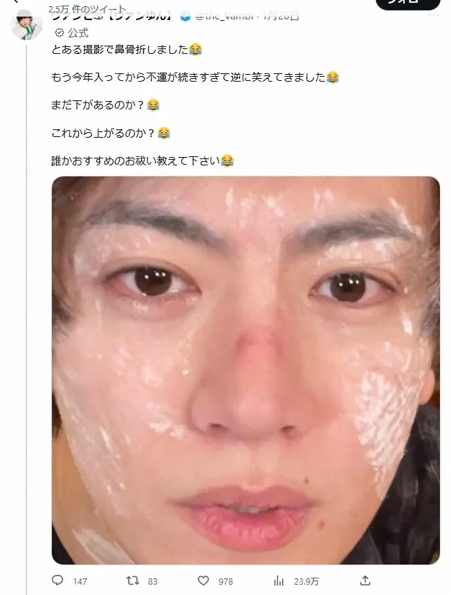 【画像・写真】不幸続きの人気YouTuber「とある撮影で鼻骨折しました」と涙の報告…年始にはインフルエンザ発症