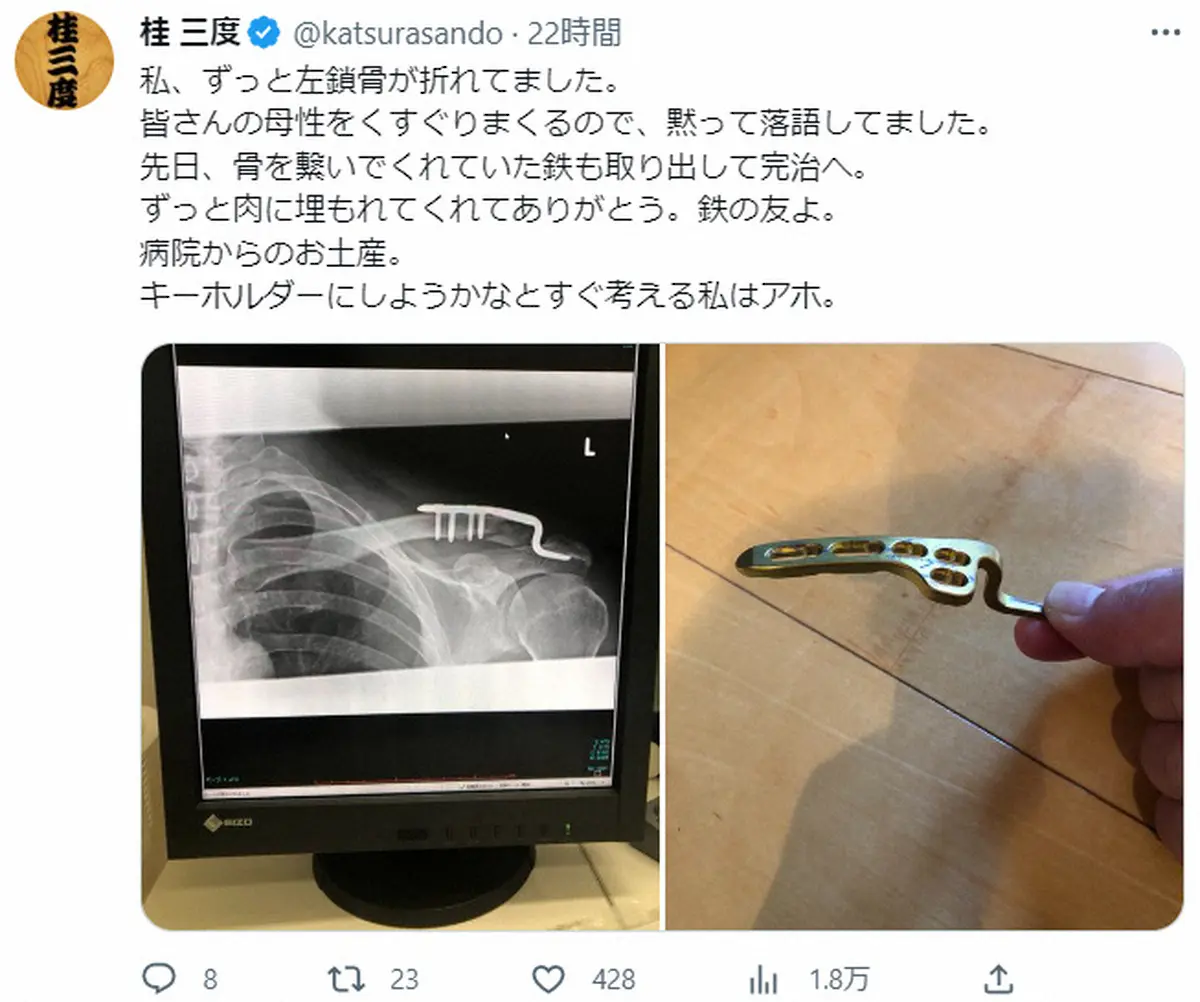 【画像・写真】桂三度　左鎖骨の骨折を告白「皆さんの母性をくすぐりまくるので、黙って落語してました」