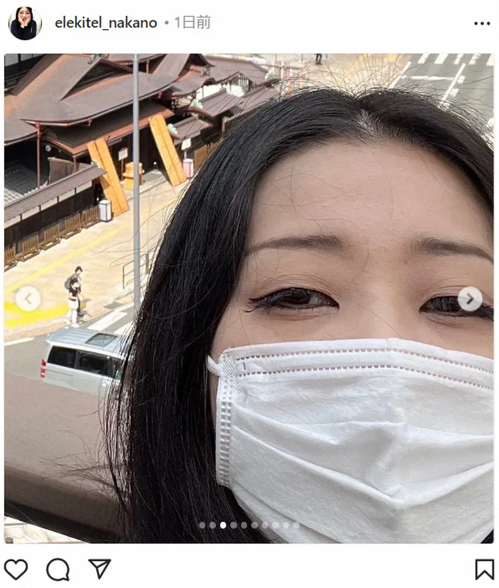 【画像・写真】日本エレキテル連合・中野　コントの顔面テープで「重度の眼瞼下垂」に　「目が半分しか開かない」