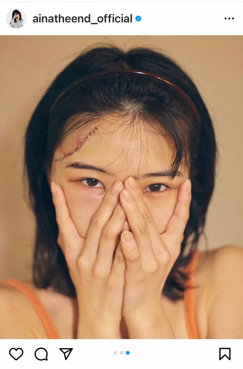 【画像・写真】頭部負傷のアイナ・ジ・エンド「表情、うまいこと動かせない」も「初心に帰れます」と前向き