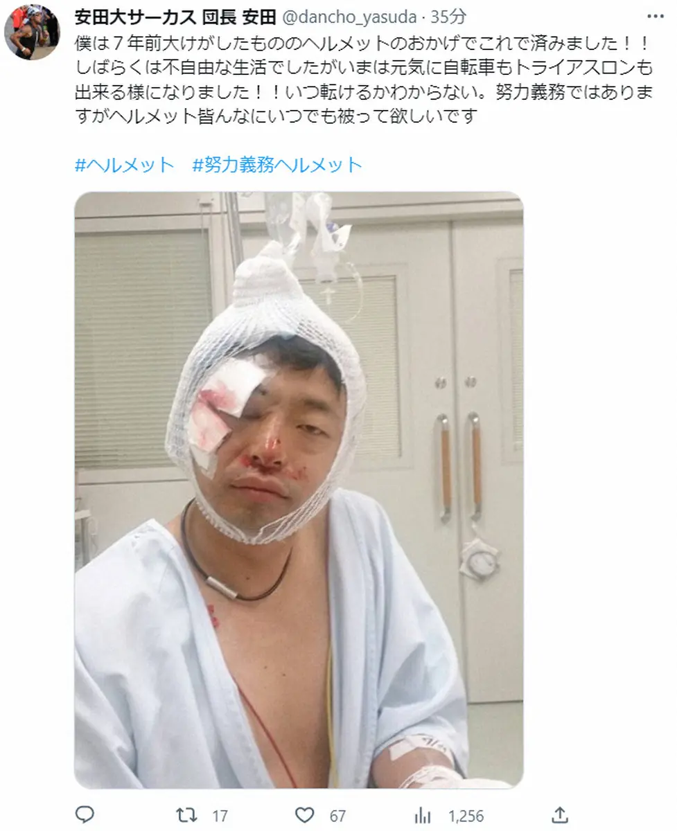 【画像・写真】団長安田　7年前の事故の凄惨な大ケガ公開　血だらけの顔に目は変色…「ヘルメット被って欲しい」