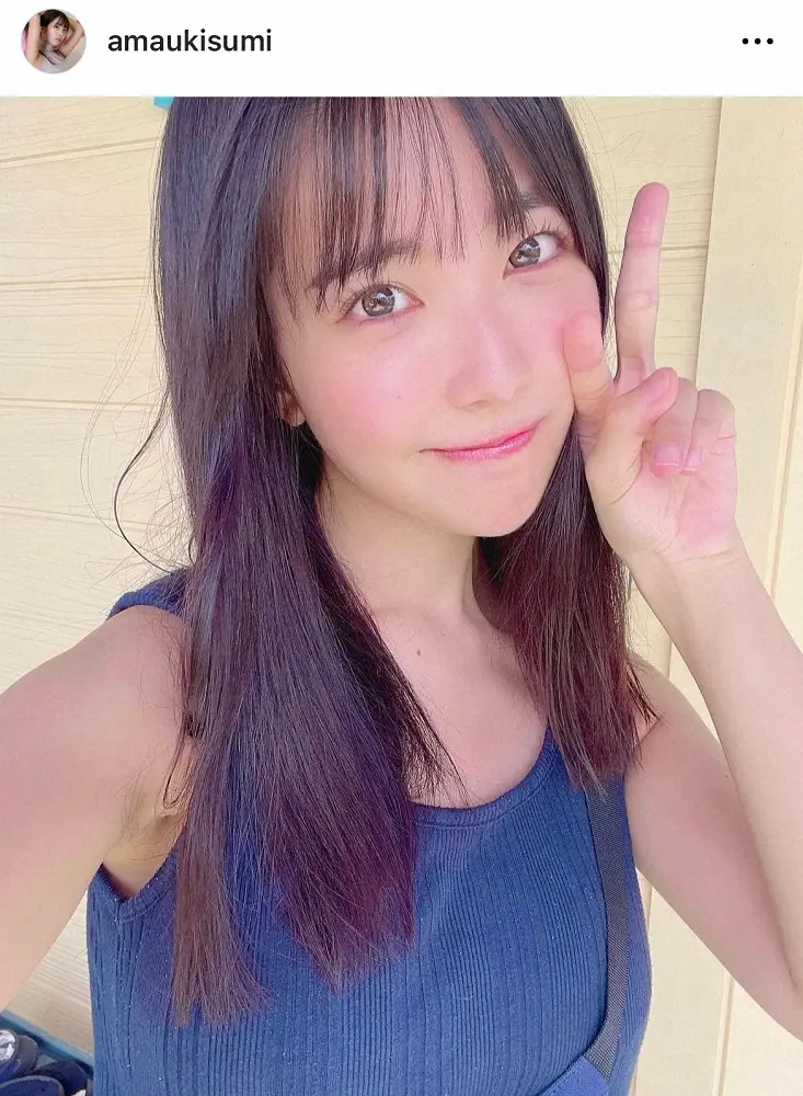 【画像・写真】人気アイドル　ライブ中にステージから転落し出血、緊急搬送　所属事務所が報告し対応を謝罪