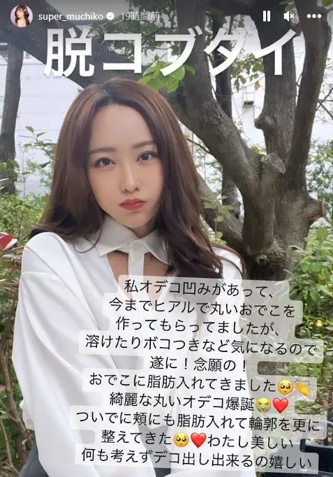 【画像・写真】てんちむ「大がかりな整形」を報告　ビフォーアフターにファン衝撃「こんなに変わるなんて」