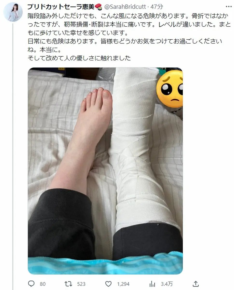【画像・写真】ブリドカットセーラ恵美「階段踏み外しただけ」で…右足首じん帯損傷・じん帯断裂　激痛に「レベル違う」