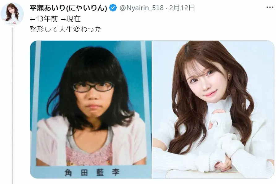 【画像・写真】25歳グラドル、アンチからの「整形は努力じゃない」意見に反論　「素敵な話」「考え変わった」称賛続々