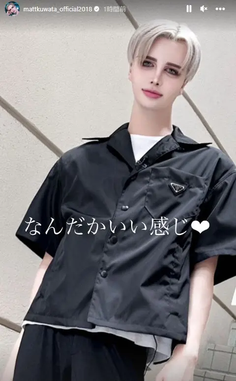 【画像・写真】Matt、アゴにヒアルロン酸大量注入で異変→遅発性結節に　現在は思わぬ変化「入れ直して…いい感じ」