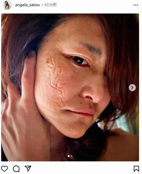 【画像・写真】アンジェラ佐藤　顔に不気味な「紋章」　フォロワー騒然「どうしたの？」「新種のタトゥーw」