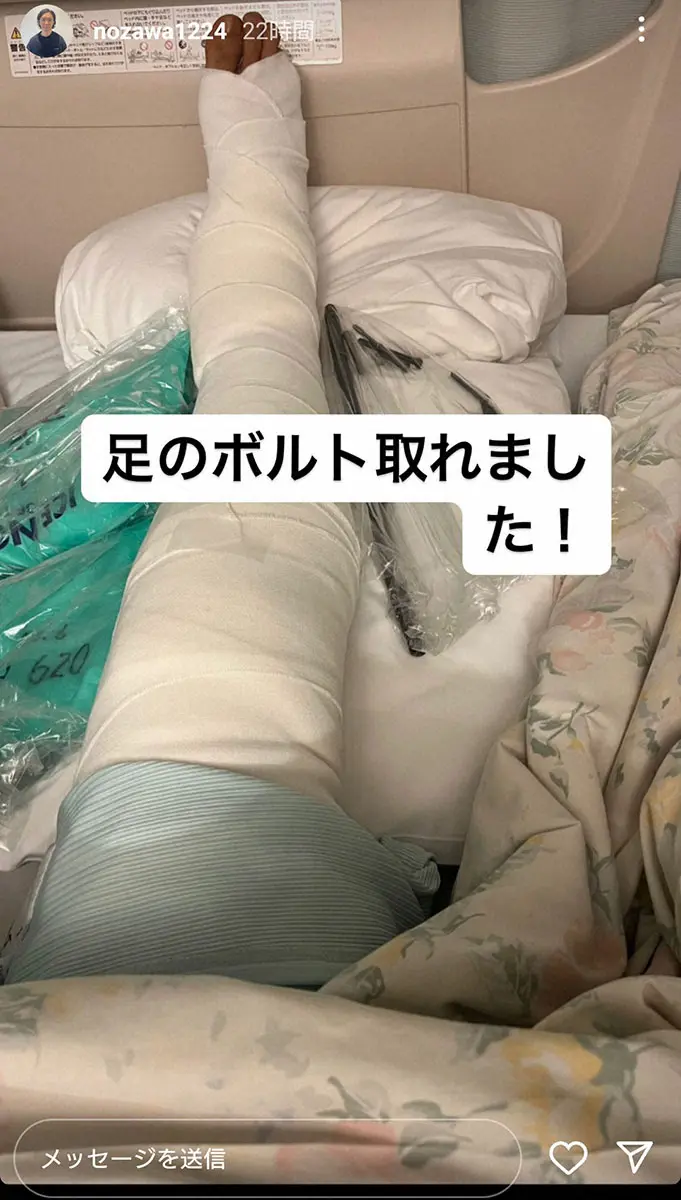 【画像・写真】「ダイヤモンド」野澤　骨折した右足からボルト摘出を報告　あまりの大きさにファンから驚きの声